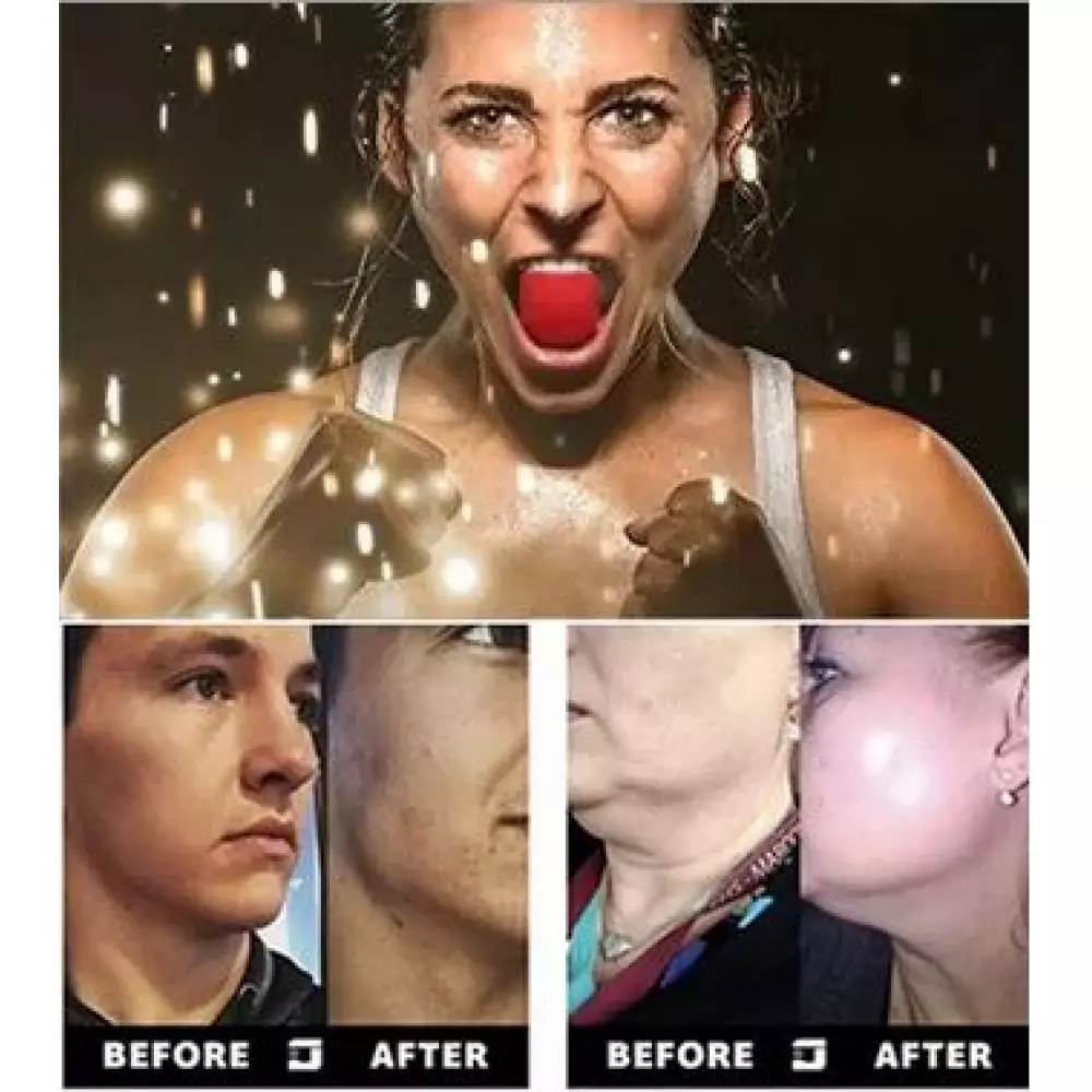 Jawline trainer des muscles de la mâchoire - raffermir les muscles du visage - Noir