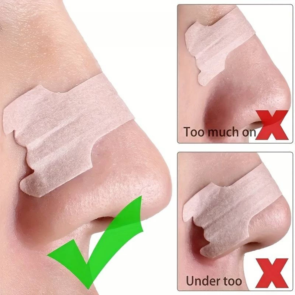 Nasenpflaster, um besser zu atmen und das Schnarchen zu reduzieren (Packung mit 10 Pflastern)